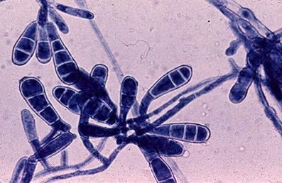 Bacteria that cause fungus on the nail